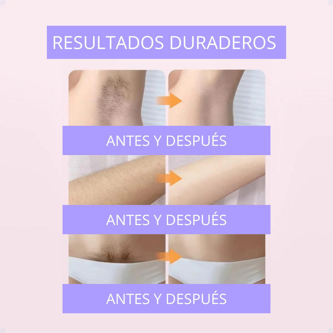 Maquina Depiladora Recargable