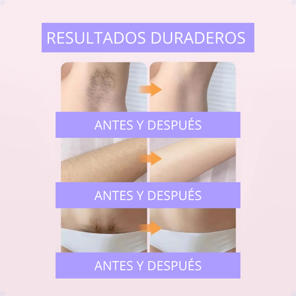 Maquina Depiladora Recargable