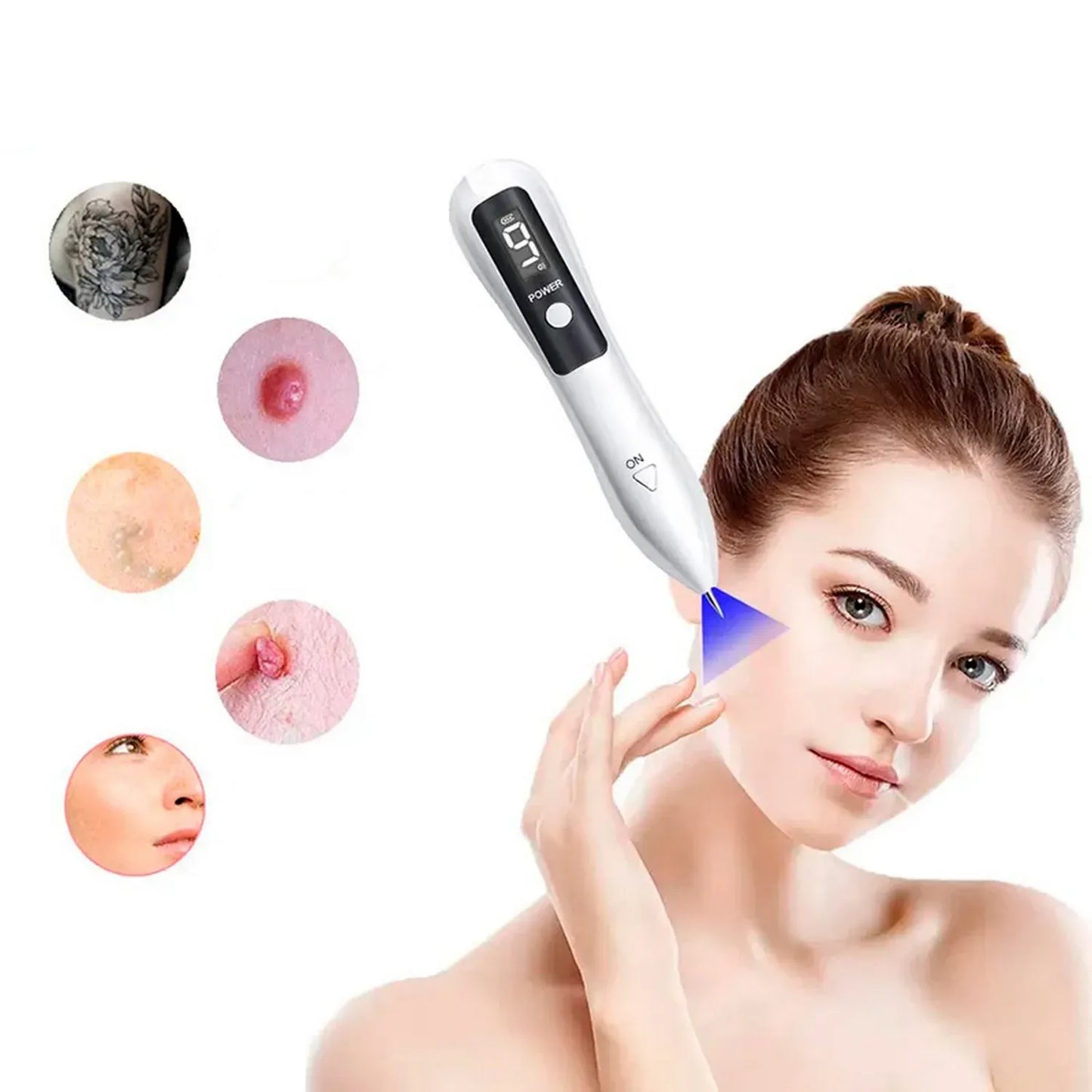 Cauterizador de verrugas/ PANTALLA LED