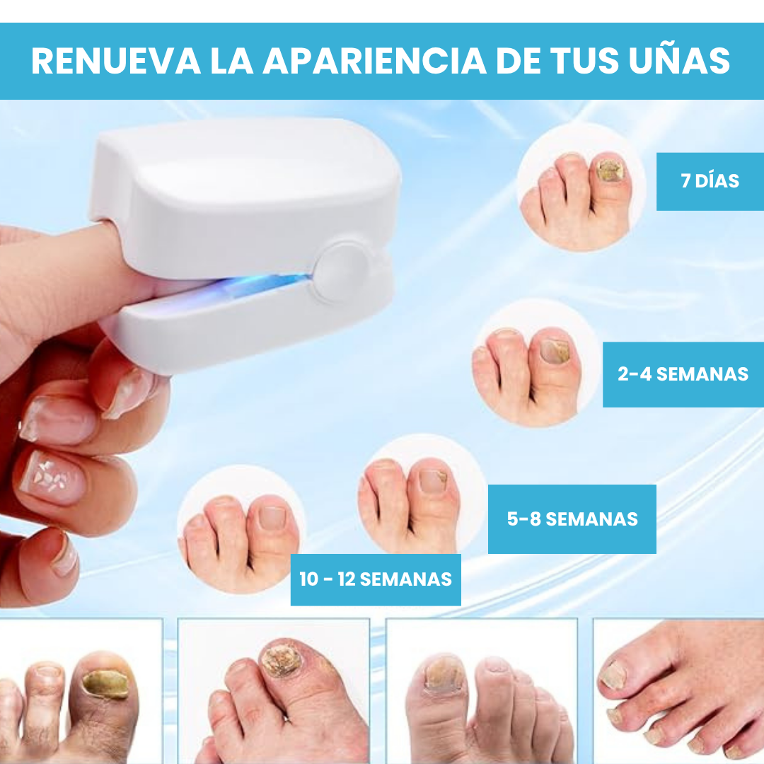 LASER ELIMINA HONGOS UÑAS